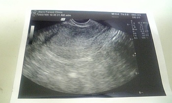 20090527 妊娠後初めての受診（まだ何も見えない）.jpg